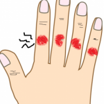 指の関節が腫れる原因は？痛いときには何科を受診すればいいの？