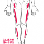 腰痛で足のしびれ！左側または右側のしびれの原因と対処法とは
