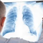 気管支喘息は咳やゼイゼイを伴う呼吸困難発作を繰り返す病気です！